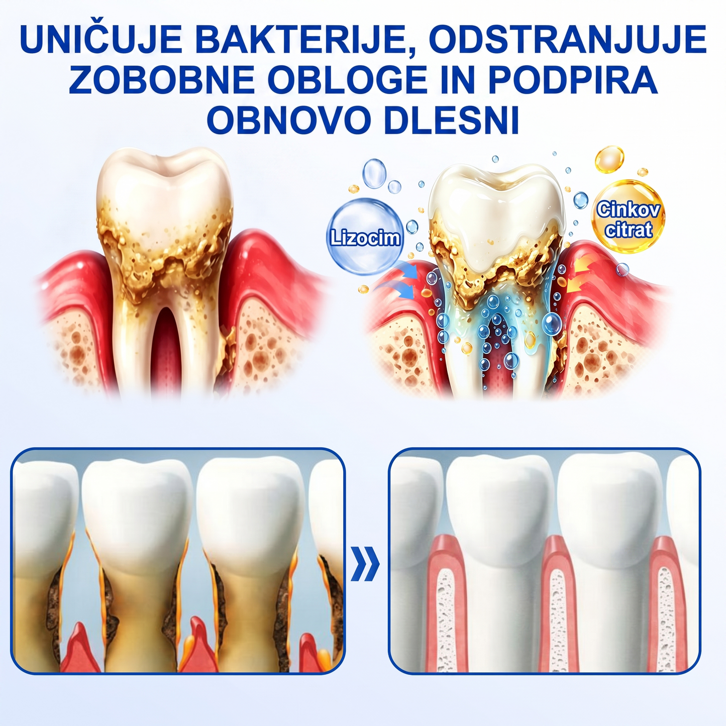 Zoencgz® 🦷🥗Antibakterijski gel za obnovo dlesni | Vidni učinki v 7 dneh
