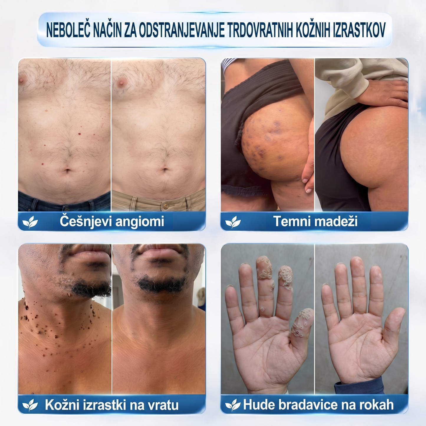 🔥 Ostalo je samo še 10 kosov! Izkoristite dodatnih 50 % popusta! 𝑯𝗲𝙖𝐥𝗿𝗶𝙯𝗲® 7-dnevni roll-on za ciljno nego kožnih nepravilnosti Tag & Spot 🪄