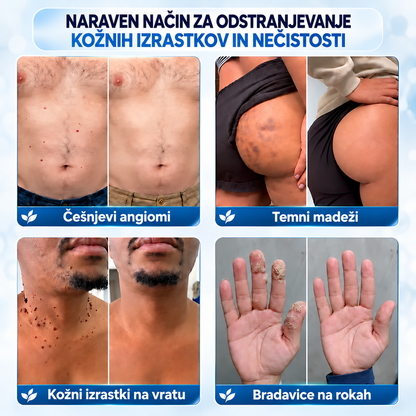 𝐇𝐞𝐚𝐥𝐫𝐢𝐳𝐞® 🧑‍⚕️🎍7-dnevna krema za odstranjevanje kožnih izrastkov in madežev🌿