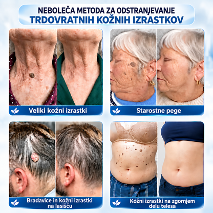 𝐇𝐞𝐚𝐥𝐫𝐢𝐳𝐞® 🧑‍⚕️🎍7-dnevna krema za odstranjevanje kožnih izrastkov in madežev🌿