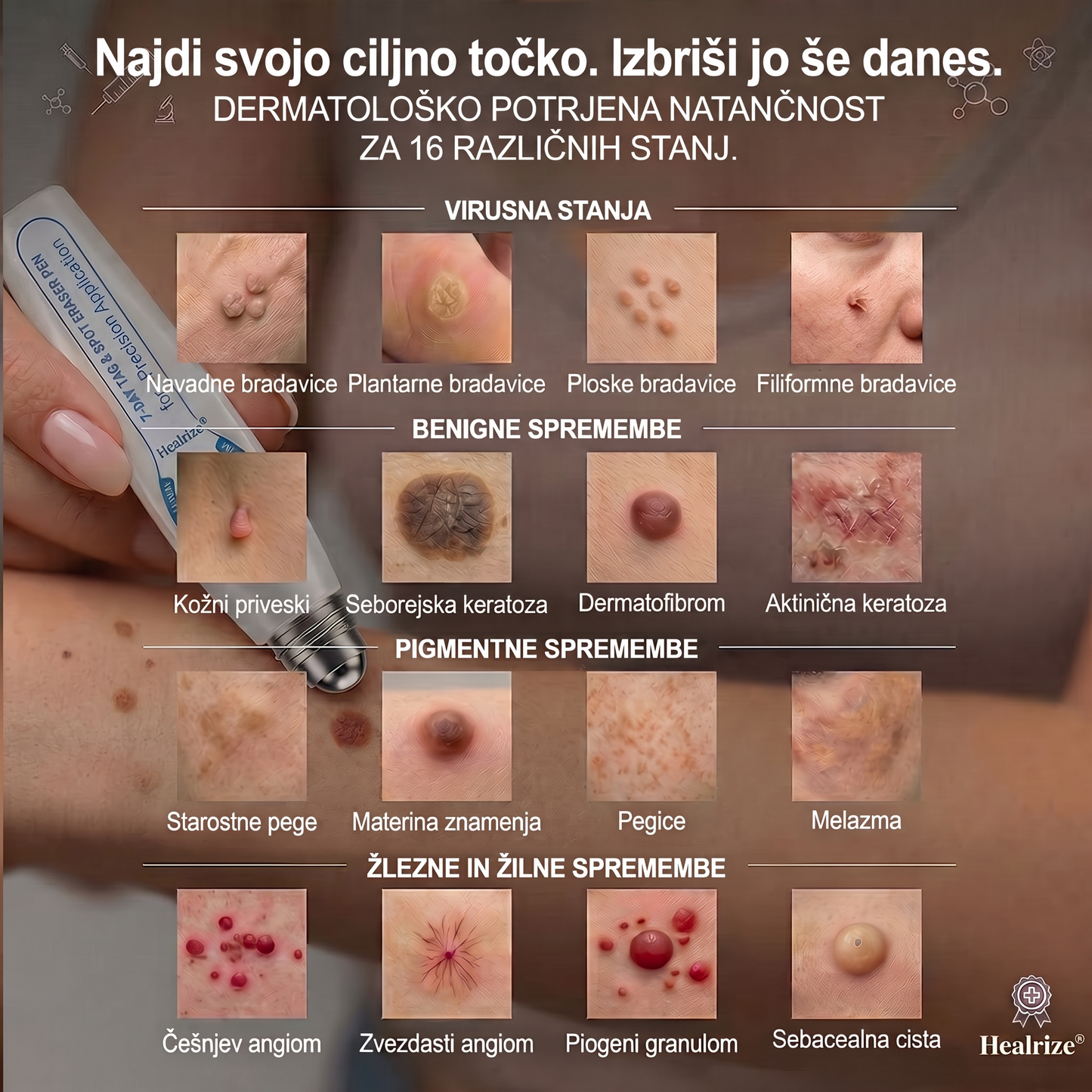 🔥 Ostalo je samo še 10 kosov! Izkoristite dodatnih 50 % popusta! 𝑯𝗲𝙖𝐥𝗿𝗶𝙯𝗲® 7-dnevni roll-on za ciljno nego kožnih nepravilnosti Tag & Spot 🪄