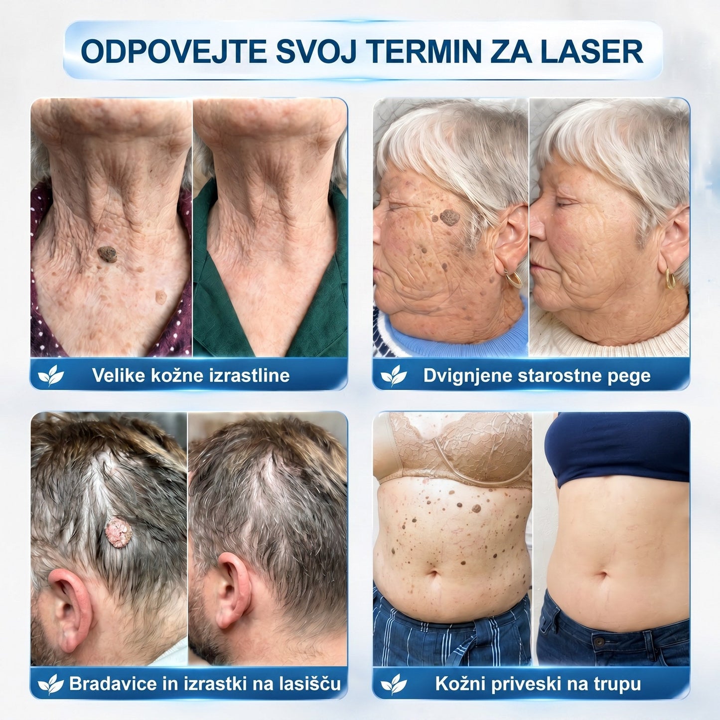 🔥 Ostalo je samo še 10 kosov! Izkoristite dodatnih 50 % popusta! 𝑯𝗲𝙖𝐥𝗿𝗶𝙯𝗲® 7-dnevni roll-on za ciljno nego kožnih nepravilnosti Tag & Spot 🪄