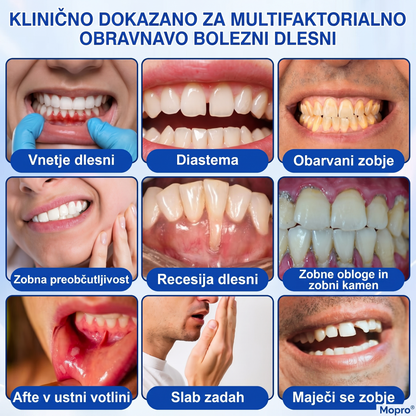 Zoencgz® 🦷🥗Antibakterijski gel za obnovo dlesni | Vidni učinki v 7 dneh